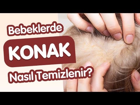 Deride Sarı Döküntüler. Konak nedir? Nasıl Temizlenir?