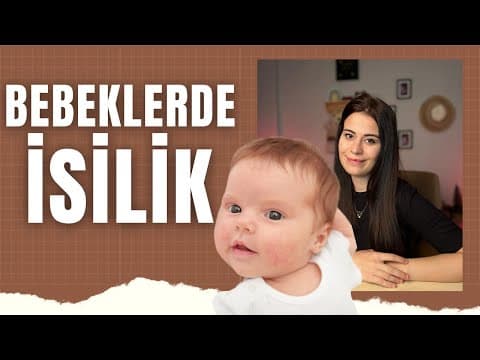 Bebeklerde İsilik Neden Olur | Nasıl Önlem Alınmalıdır | Tedavi Gerektirir mi?